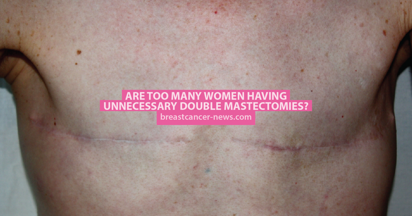 Are Too Many Women Having Unnecessary Double Mastectomies ...